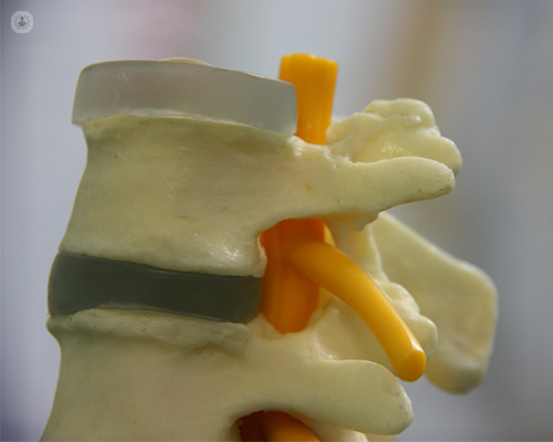 Artrodesis vertebral por endoscopia en Madrid